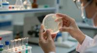 Lucas, Monroe counties investigating recent cases of intestinal illness Cyclosporiasis